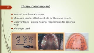 Intramucosal implant
 Inserted into the oral mucosa
 Mucosa is used as attachment site for the metal inserts
 Disadvantages – painful healing, requirements for continual
wear
 No longer used.
36
 