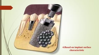 4.Based on implant surface
characteristic
 