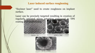 Laser induced surface roughening
“Excimer laser” used to create roughness on implant
surface.
Laser can be precisely targeted resulting in creation of
regularly oriented micro retention compared to TPS
coating and sandblasting
SEM x 3000
SEM x 300
SEM x 70
 