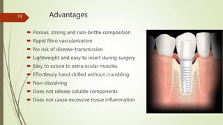 Advantages
 Porous, strong and non-brittle composition
 Rapid fibro vascularization
 No risk of disease-transmission
 Lightweight and easy to insert during surgery
 Easy to suture to extra ocular muscles
 Effortlessly hand-drilled without crumbling
 Non-dissolving
 Does not release soluble components
 Does not cause excessive tissue inflammation
74
 