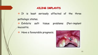 AILING IMPLANTS
 It is least seriously affected of the three
pathologic states.
 Exhibits soft tissue problems (Peri-implant
mucositis.
 Have a favourable prognosis.
88
 