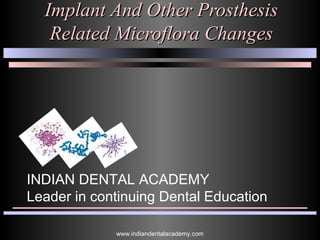 Implant And Other ProsthesisImplant And Other Prosthesis
Related Microflora ChangesRelated Microflora Changes
INDIAN DENTAL ACADEMY
Leader in continuing Dental Education
www.indiandentalacademy.com
 