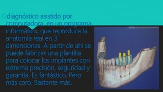 diagnóstico asistido por
computadora. en un programa
informático, que reproduce la
anatomía real en 3
dimensiones. A partir de ahí se
puede fabricar una plantilla
para colocar los implantes con
extrema precisión, seguridad y
garantía. Es fantástico. Pero
más caro. Bastante más.
 