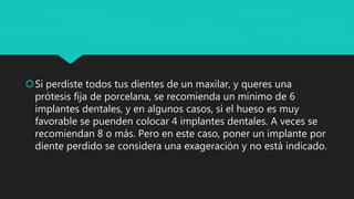 Si perdiste todos tus dientes de un maxilar, y queres una
prótesis fija de porcelana, se recomienda un mínimo de 6
implantes dentales, y en algunos casos, si el hueso es muy
favorable se puenden colocar 4 implantes dentales. A veces se
recomiendan 8 o más. Pero en este caso, poner un implante por
diente perdido se considera una exageración y no está indicado.
 