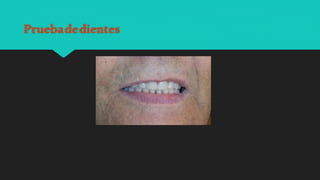 Pruebadedientes
 