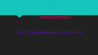 5MESESDESPUÉS
PRÓTESISHÍBRIDADEFINITIVA
 