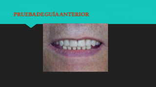 PRUEBADEGUÍAANTERIOR
 