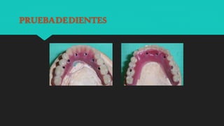 PRUEBADEDIENTES
 