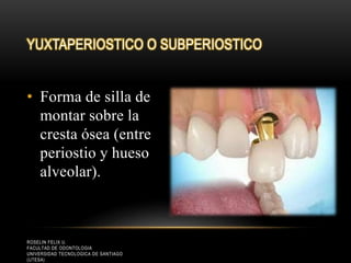 • Forma de silla de
montar sobre la
cresta ósea (entre
periostio y hueso
alveolar).
YUXTAPERIOSTICO O SUBPERIOSTICO
ROSELIN FELIX U.
FACULTAD DE ODONTOLOGIA
UNIVERSIDAD TECNOLOGICA DE SANTIAGO
(UTESA)
 