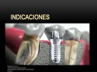 INDICACIONES
ROSELIN FELIX U.
FACULTAD DE ODONTOLOGIA
UNIVERSIDAD TECNOLOGICA DE SANTIAGO
(UTESA)
 