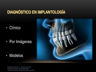 ROSELIN FELIX U. FACULTAD DE
ODONTOLOGIA UNIVERSIDAD
TECNOLOGICA DE SANTIAGO (UTESA)
DIAGNÓSTICO EN IMPLANTOLOGÍA
• Clínico
• Por Imágenes
• Modelos
 
