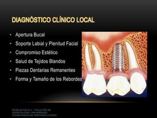 ROSELIN FELIX U. FACULTAD DE
ODONTOLOGIA UNIVERSIDAD
TECNOLOGICA DE SANTIAGO (UTESA)
DIAGNÓSTICO CLÍNICO LOCAL
• Apertura Bucal
• Soporte Labial y Plenitud Facial
• Compromiso Estético
• Salud de Tejidos Blandos
• Piezas Dentarias Remanentes
• Forma y Tamaño de los Rebordes
 