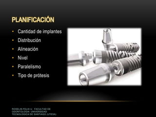 PLANIFICACIÓN
ROSELIN FELIX U. FACULTAD DE
ODONTOLOGIA UNIVERSIDAD
TECNOLOGICA DE SANTIAGO (UTESA)
• Cantidad de implantes
• Distribución
• Alineación
• Nivel
• Paralelismo
• Tipo de prótesis
 