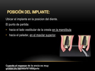 POSICIÓN DEL IMPLANTE:
Ubicar el implante en la posicion del diente.
El punto de partida:
• hacia el lado vestibular de la cresta en la mandíbula
• hacia el paladar, en el maxilar superior.
Cuando el espesor de la encia es muy
grueso es necesario rebajarlo
ROSELIN FELIX U. FACULTAD DE
ODONTOLOGIA UNIVERSIDAD TECNOLOGICA
DE SANTIAGO (UTESA)
 