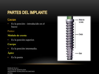 Cuerpo
• Es la porción - introducido en el
hueso
Partes:
Módulo de cresta
• Es la porción superior.
Cuerpo
• Es la porción intermedia.
Ápice
• Es la punta
PARTES DEL IMPLANTE
ROSELIN FELIX U.
FACULTAD DE ODONTOLOGIA
UNIVERSIDAD TECNOLOGICA DE SANTIAGO
(UTESA)
 