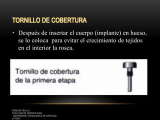 TORNILLO DE COBERTURA
• Después de insertar el cuerpo (implante) en hueso,
se lo coloca para evitar el crecimiento de tejidos
en el interior la rosca.
ROSELIN FELIX U.
FACULTAD DE ODONTOLOGIA
UNIVERSIDAD TECNOLOGICA DE SANTIAGO
(UTESA)
 
