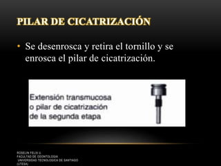 PILAR DE CICATRIZACIÓN
• Se desenrosca y retira el tornillo y se
enrosca el pilar de cicatrización.
ROSELIN FELIX U.
FACULTAD DE ODONTOLOGIA
UNIVERSIDAD TECNOLOGICA DE SANTIAGO
(UTESA)
 