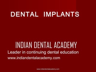 DENTAL IMPLANTS

INDIAN DENTAL ACADEMY

Leader in continuing dental education
www.indiandentalacademy.com
www.indiandentalacademy.com

 