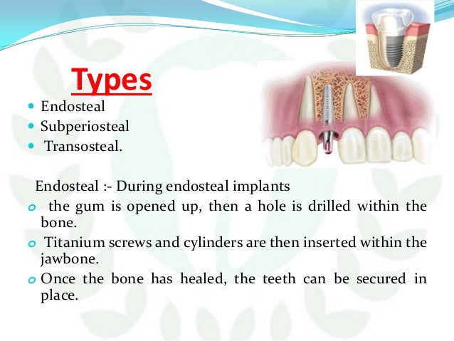 endosteal implant under fontanacountryinn com endosteal implant