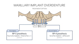 Maxillary Rp IMPLANT OVERDENTURES BEY NURIL.pptx
