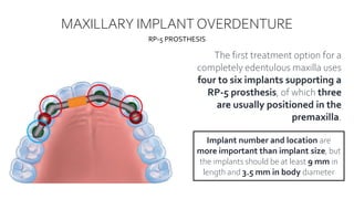 Maxillary Rp IMPLANT OVERDENTURES BEY NURIL.pptx