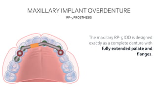 Maxillary Rp IMPLANT OVERDENTURES BEY NURIL.pptx