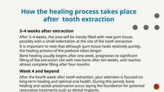 Tooth Extraction Week 4 Comprehensive Protocols for Dental Implant Placement Post-Extraction | PPTX