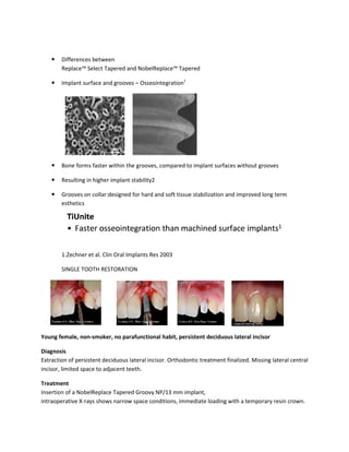 Differences between
Replace™ Select Tapered and NobelReplace™ Tapered
Implant surface and grooves
Bone forms faster within the grooves, compared to implant surfaces without grooves
Resulting in higher implant stability2
Grooves on collar:designed
esthetics
1.Zechner et al. Clin Oral Implants Res 2003
SINGLE TOOTH RESTORATION
Young female, non-smoker, no parafunctional habit, persistent deciduous lateral incisor
Diagnosis
Extraction of persistent deciduous lateral incisor. Orthodontic treatment finalized. Missing lateral central
incisor, limited space to adjacent teeth.
Treatment
Insertion of a NobelReplace Tapered Groovy NP/13 mm implant,
intraoperative X-rays shows narrow space conditions, immediate loading with a temporary resin crown.
Replace™ Select Tapered and NobelReplace™ Tapered
surface and grooves – Osseointegration1
Bone forms faster within the grooves, compared to implant surfaces without grooves
Resulting in higher implant stability2
for hard and soft tissue stabilization and improved long term
Zechner et al. Clin Oral Implants Res 2003
SINGLE TOOTH RESTORATION
smoker, no parafunctional habit, persistent deciduous lateral incisor
Extraction of persistent deciduous lateral incisor. Orthodontic treatment finalized. Missing lateral central
incisor, limited space to adjacent teeth.
Insertion of a NobelReplace Tapered Groovy NP/13 mm implant,
shows narrow space conditions, immediate loading with a temporary resin crown.
Bone forms faster within the grooves, compared to implant surfaces without grooves
for hard and soft tissue stabilization and improved long term
smoker, no parafunctional habit, persistent deciduous lateral incisor
Extraction of persistent deciduous lateral incisor. Orthodontic treatment finalized. Missing lateral central
shows narrow space conditions, immediate loading with a temporary resin crown.
 