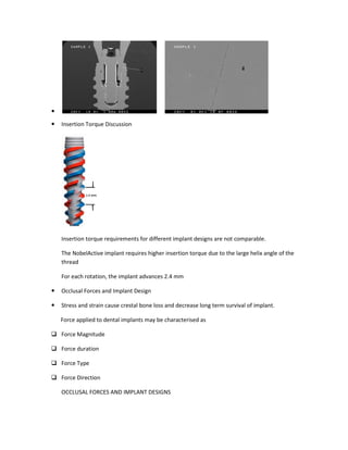 Insertion Torque Discussion
Insertion torque requirements for different implant designs are not comparable.
The NobelActive implant requires higher insertion torque due to the large helix angle of the
thread
For each rotation, the implant advances 2.4 mm
Occlusal Forces and Implant Design
Stress and strain cause crestal bone loss and decrease long term survival of implant.
Force applied to dental implants may be characterised as
Force Magnitude
Force duration
Force Type
Force Direction
OCCLUSAL FORCES AND IMPLANT DESIGNS
Insertion Torque Discussion
e requirements for different implant designs are not comparable.
The NobelActive implant requires higher insertion torque due to the large helix angle of the
For each rotation, the implant advances 2.4 mm
Occlusal Forces and Implant Design
and strain cause crestal bone loss and decrease long term survival of implant.
Force applied to dental implants may be characterised as
OCCLUSAL FORCES AND IMPLANT DESIGNS
e requirements for different implant designs are not comparable.
The NobelActive implant requires higher insertion torque due to the large helix angle of the
and strain cause crestal bone loss and decrease long term survival of implant.
 