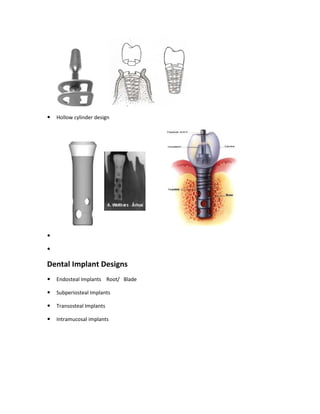 Hollow cylinder design
Dental Implant Designs
Endosteal Implants Root/ Blade
Subperiosteal Implants
Transosteal Implants
Intramucosal implants
 
