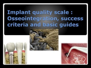 Implant quality scale :
Osseointegration, success
criteria and basic guides
 