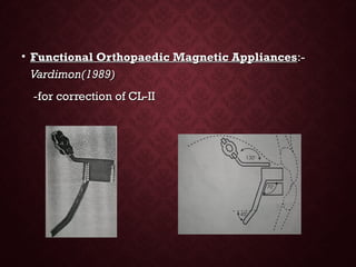 • Functional Orthopaedic Magnetic AppliancesFunctional Orthopaedic Magnetic Appliances:-:-
Vardimon(1989)Vardimon(1989)
--for correction of CL-IIfor correction of CL-II
 