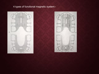 4 types of functional magnetic system:-
 