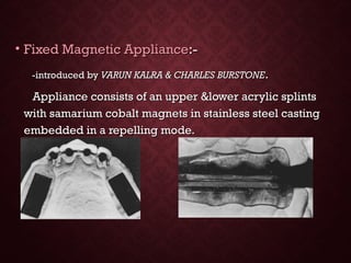 • Fixed Magnetic ApplianceFixed Magnetic Appliance:-:-
-introduced by-introduced by VARUN KALRA & CHARLES BURSTONEVARUN KALRA & CHARLES BURSTONE..
Appliance consists of an upper &lower acrylic splintsAppliance consists of an upper &lower acrylic splints
with samarium cobalt magnets in stainless steel castingwith samarium cobalt magnets in stainless steel casting
embedded in a repelling mode.embedded in a repelling mode.
 