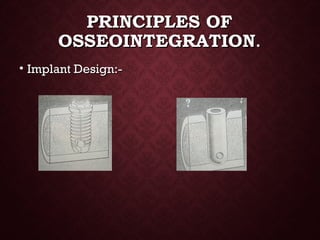 PRINCIPLES OFPRINCIPLES OF
OSSEOINTEGRATIONOSSEOINTEGRATION..
• Implant Design:-Implant Design:-
 