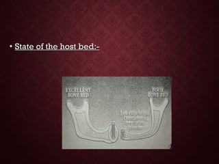 • State of the host bed:-State of the host bed:-
 