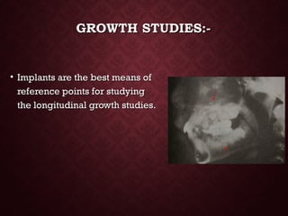 GROWTH STUDIES:-GROWTH STUDIES:-
• Implants are the best means ofImplants are the best means of
reference points for studyingreference points for studying
the longitudinal growth studies.the longitudinal growth studies.
 