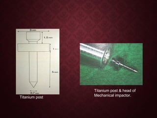 Titanium post
Titanium post & head of
Mechanical impactor.
 