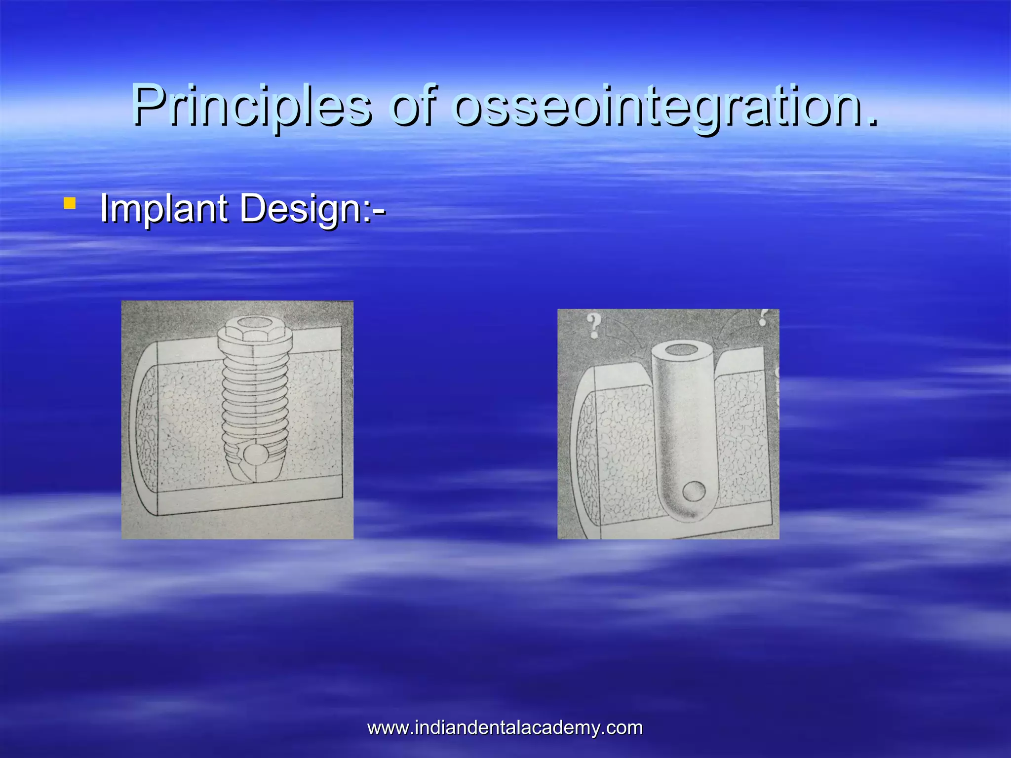 Principles of osseointegration.
 Implant Design:-

www.indiandentalacademy.com

 