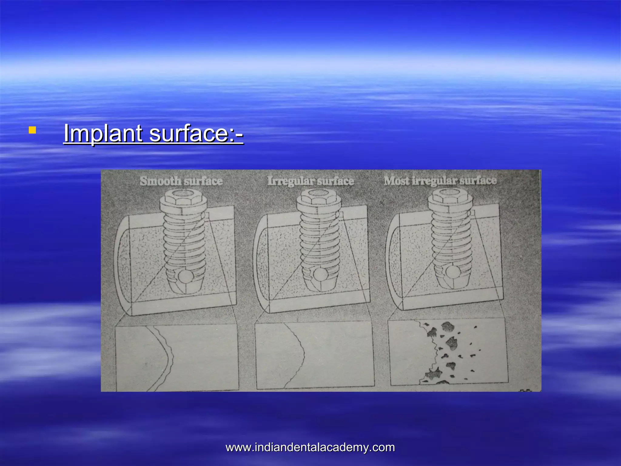 

Implant surface:-

www.indiandentalacademy.com

 