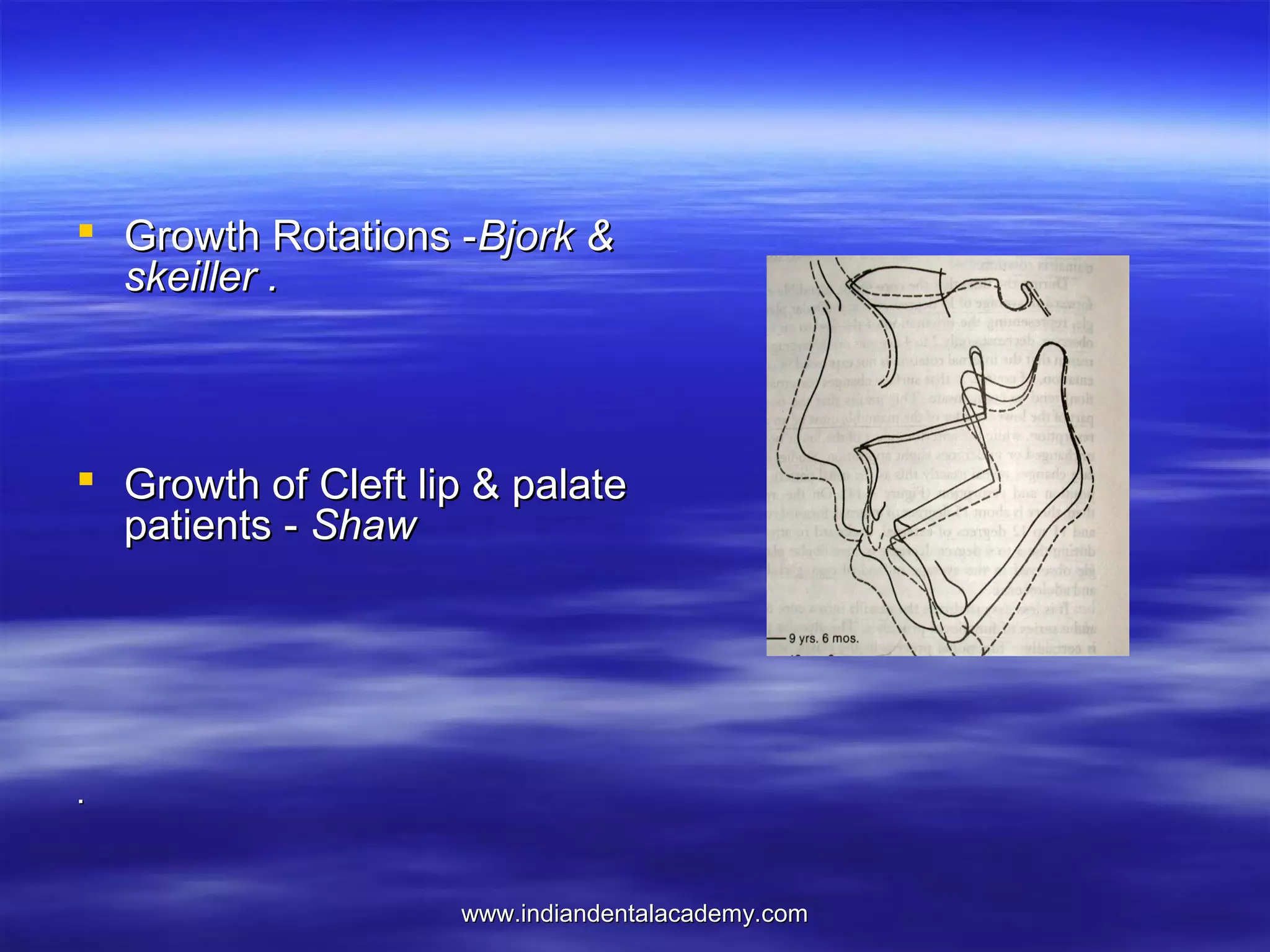  Growth Rotations -Bjork &
skeiller .

 Growth of Cleft lip & palate
patients - Shaw

.

www.indiandentalacademy.com

 