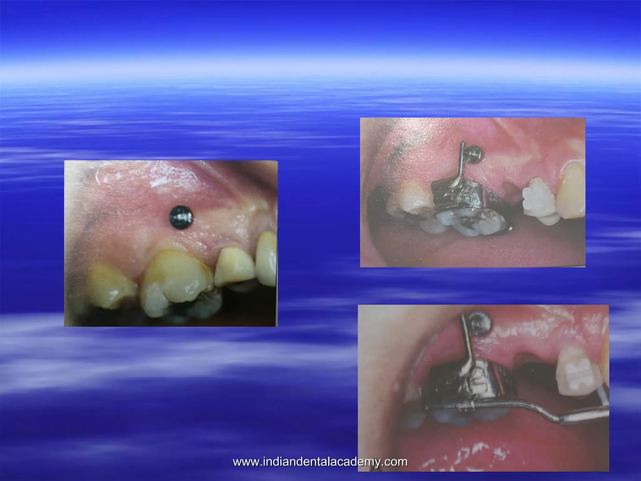 www.indiandentalacademy.com

 