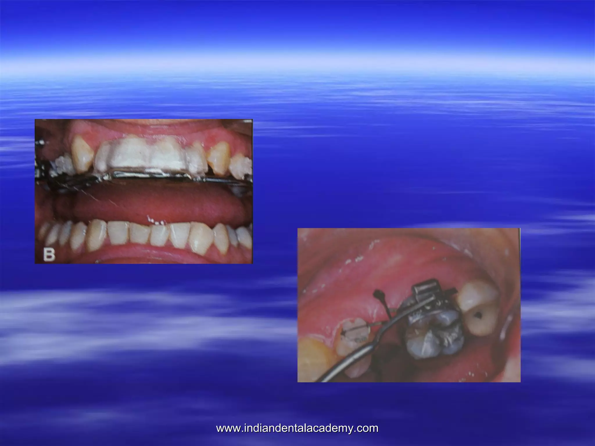 www.indiandentalacademy.com

 