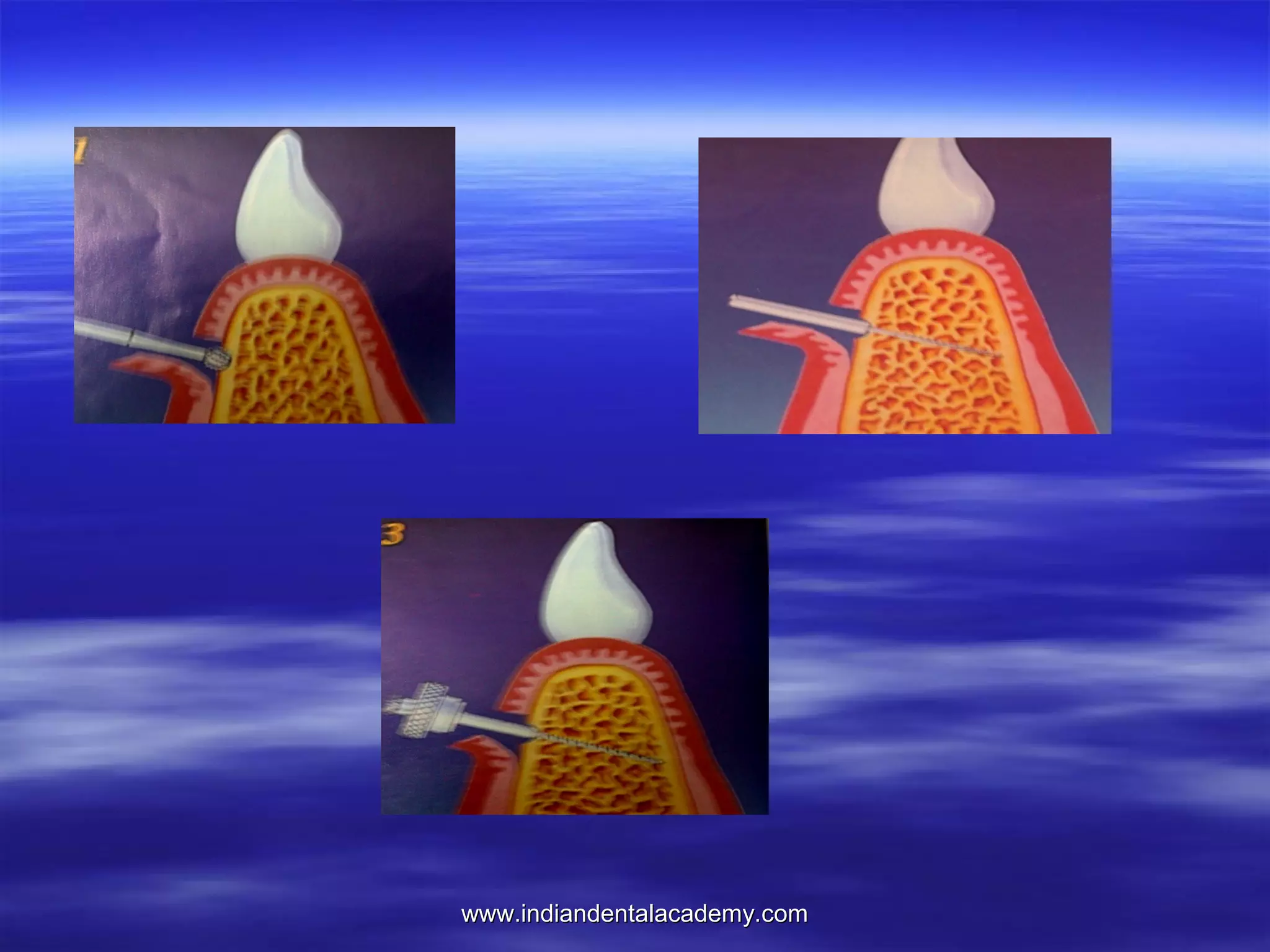 www.indiandentalacademy.com

 