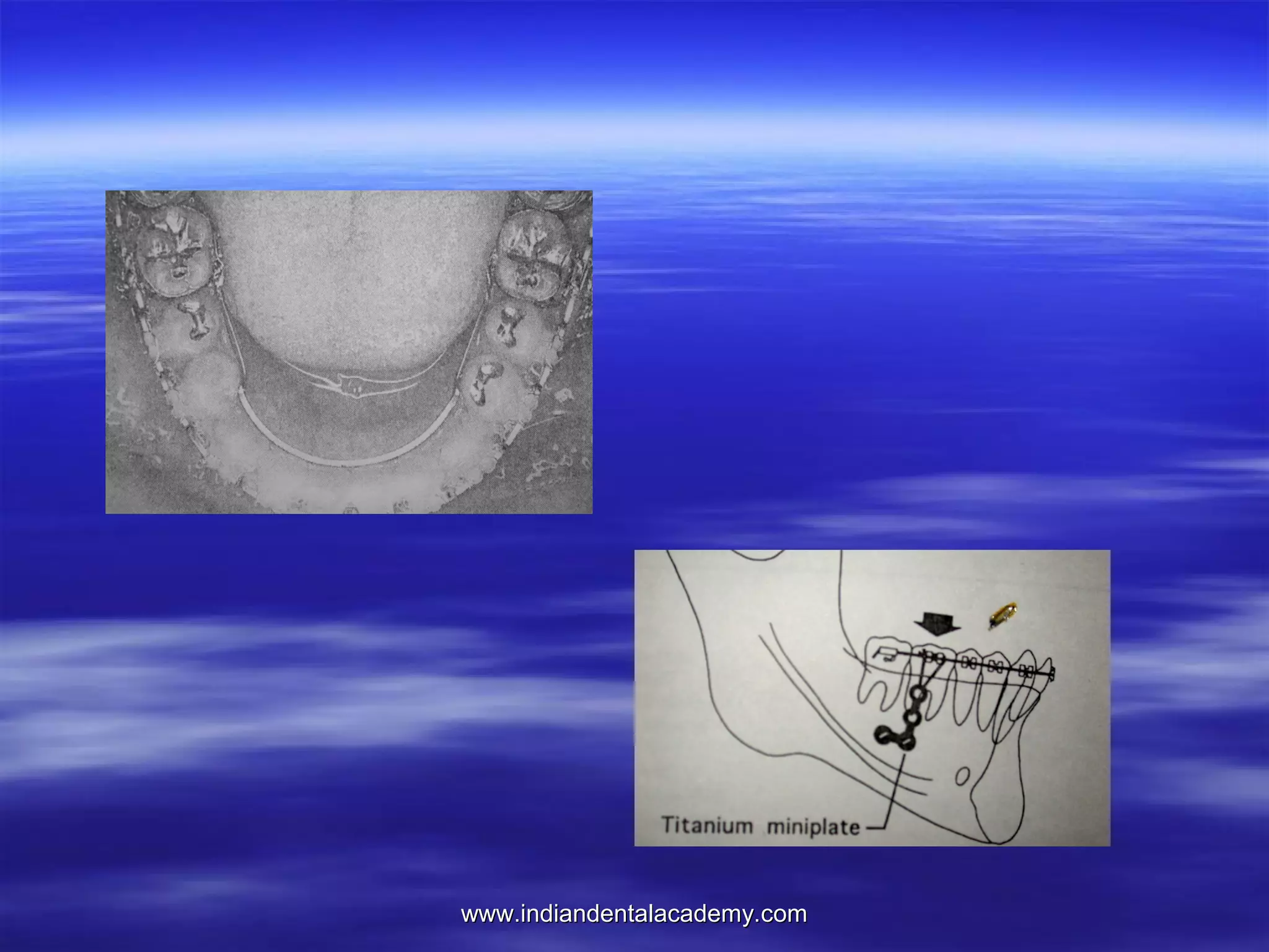 www.indiandentalacademy.com

 