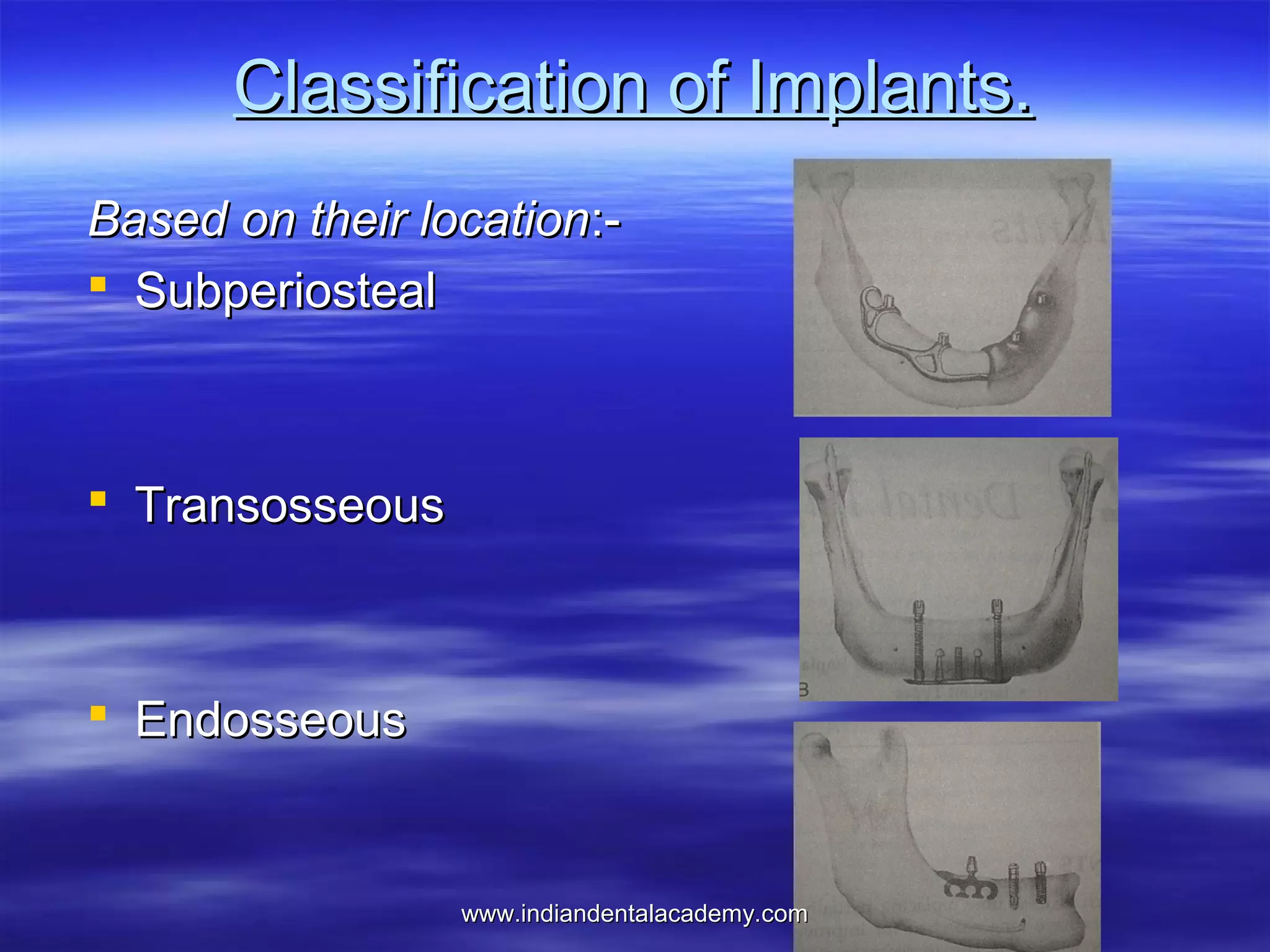 Classification of Implants.
Based on their location: Subperiosteal

 Transosseous

 Endosseous

www.indiandentalacademy.com

 