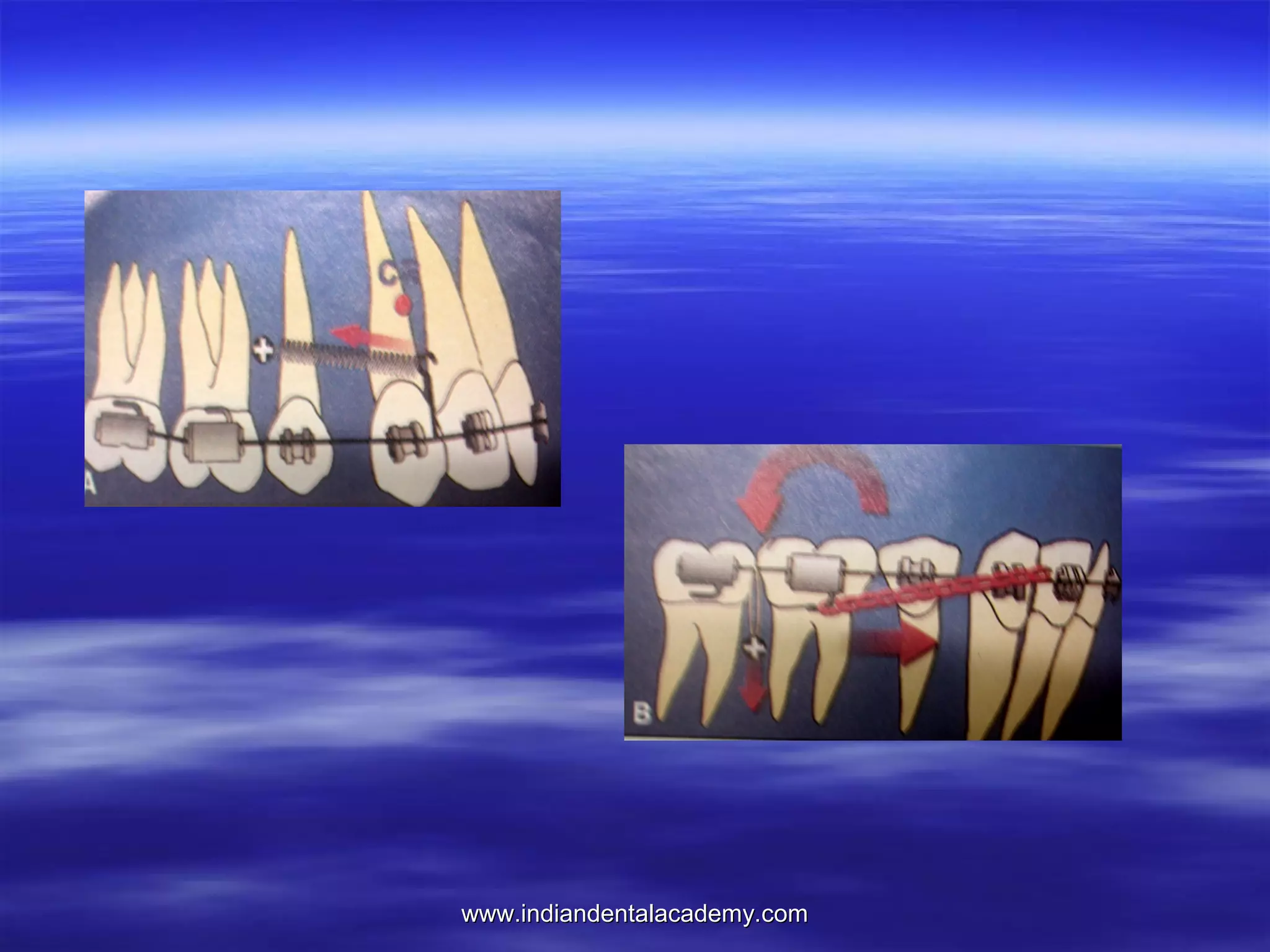 www.indiandentalacademy.com

 