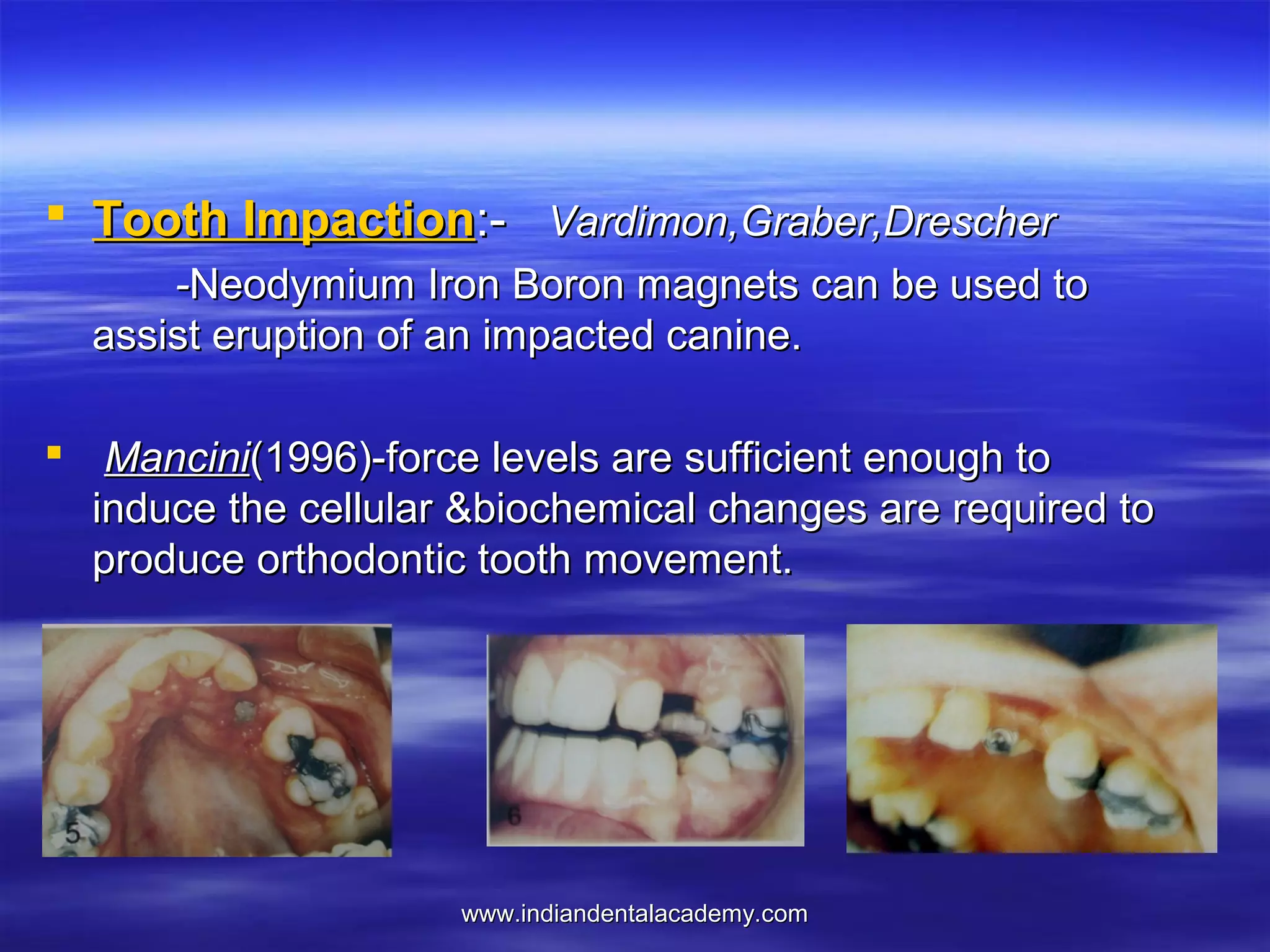  Tooth Impaction:- Vardimon,Graber,Drescher
-Neodymium Iron Boron magnets can be used to
assist eruption of an impacted canine.
 Mancini(1996)-force levels are sufficient enough to
induce the cellular &biochemical changes are required to
produce orthodontic tooth movement.

www.indiandentalacademy.com

 