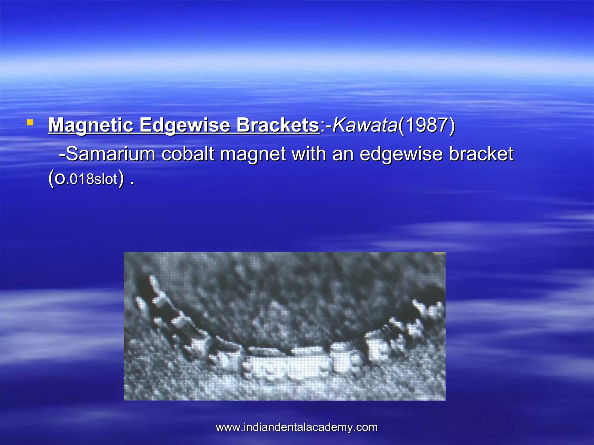  Magnetic Edgewise Brackets:-Kawata(1987)
-Samarium cobalt magnet with an edgewise bracket
(o.018slot) .

www.indiandentalacademy.com

 
