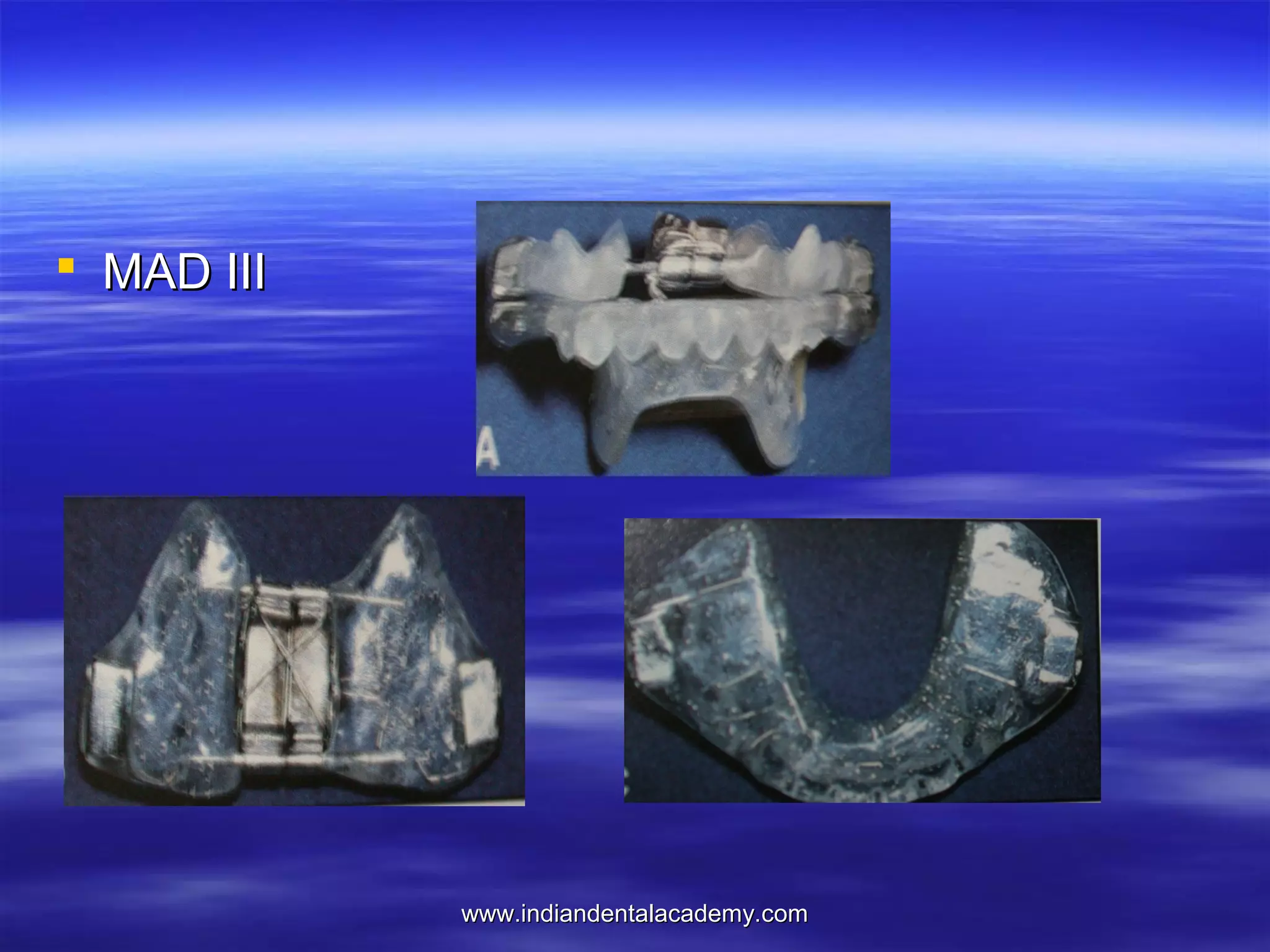  MAD III

www.indiandentalacademy.com

 